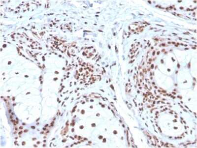 Immunohistochemistry-Paraffin: NPM1 Antibody (NPM1/3286) [NBP2-79740]