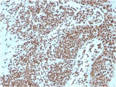 Immunohistochemistry-Paraffin: NPM1 Antibody (NPM1/3287) [NBP2-79741]