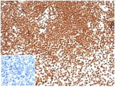 Immunohistochemistry-Paraffin: NPM1 Antibody (NPM1/7072R) [NBP3-13983]