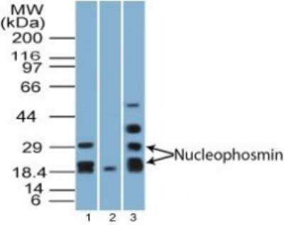 Western Blot: NPM1 Antibody [NBP2-27157]