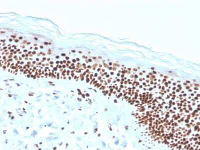 Immunohistochemistry-Paraffin: NPM1 Antibody (rNPM1/1901) - Azide and BSA Free [NBP3-08750]