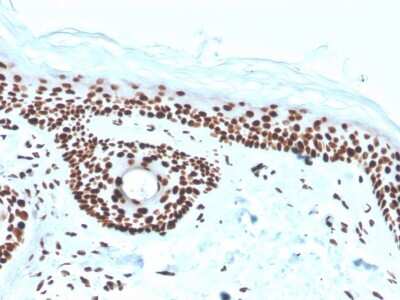 Immunohistochemistry-Paraffin: NPM1 Antibody (rNPM1/1901) [NBP3-07449]