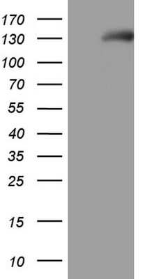 Western Blot: NPRA/NPR1 Antibody (OTI7H7) [NBP2-46202]