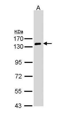 Western Blot: NPRA/NPR1 Antibody [NBP1-32889]