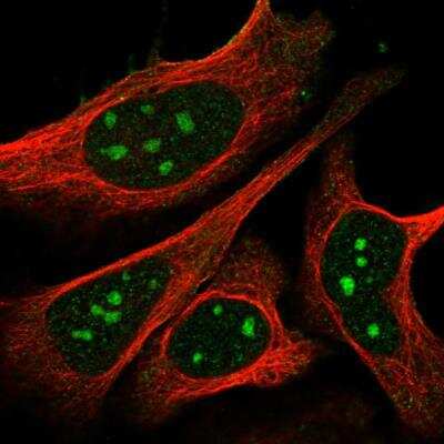Immunocytochemistry/ Immunofluorescence: NPRA/NPR1 Antibody [NBP1-90164]
