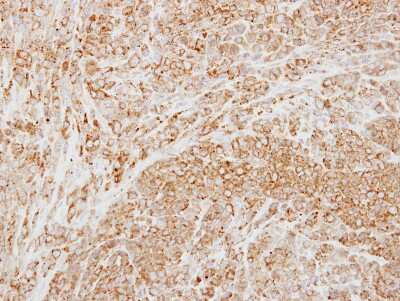 Immunohistochemistry-Paraffin: Neuronal Pentraxin 2 Antibody [NBP2-19572]