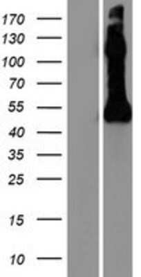 Western Blot: Neuronal Pentraxin 2 Overexpression Lysate [NBP2-08106]