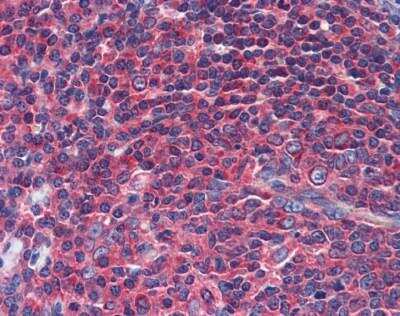 Immunohistochemistry-Paraffin: NPY1R Antibody [NBP1-59008]