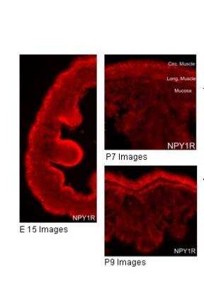 Immunohistochemistry-Paraffin: NPY1R Antibody [NBP1-59008]