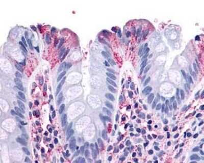 Immunohistochemistry-Paraffin: NPY1R Antibody - BSA Free [NLS1065]