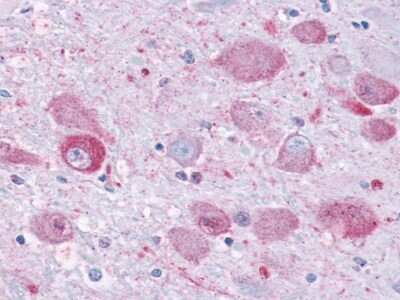 Immunohistochemistry-Paraffin: NPY1R Antibody - BSA Free [NLS1065]