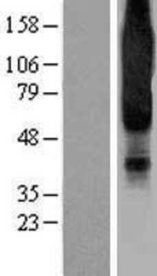 Western Blot: NPY1R Overexpression Lysate [NBP2-04180]