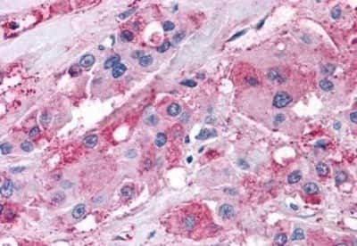 Immunohistochemistry: NPY5R Antibody [NBP3-14426]