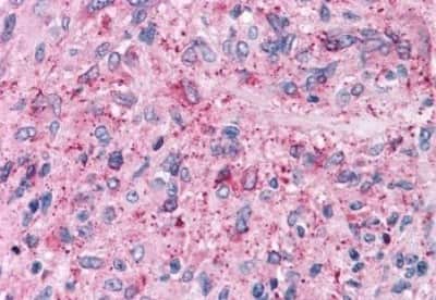 Immunohistochemistry-Paraffin: NPY5R Antibody [NBP3-14426]