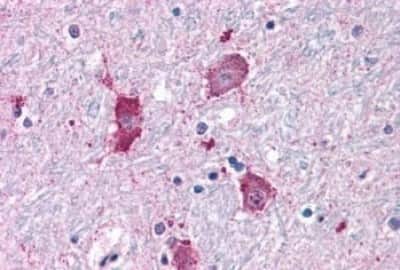 Immunohistochemistry-Paraffin: NPY5R Antibody [NBP3-14426]