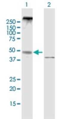 Western Blot: NPY5R Antibody [H00004889-B01P]