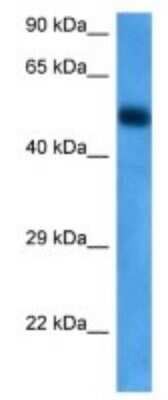 Western Blot: NPY5R Antibody [NBP3-09980]