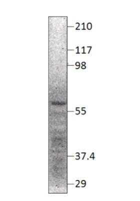 Western Blot: NPY5R Antibody [NBP3-12480]