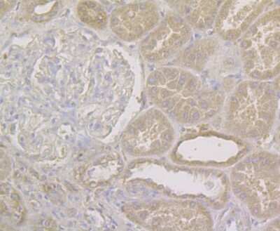 Immunohistochemistry-Paraffin: NQO-1 Antibody (13A1) [NBP2-80395]