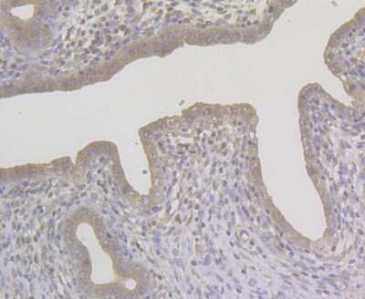 Immunohistochemistry-Paraffin: NQO-1 Antibody (13A1) [NBP2-80395]