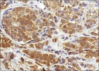 Immunohistochemistry: NQO-1 Antibody (A180) - Azide and BSA Free [NBP2-80885]