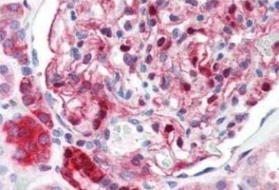 Immunohistochemistry-Paraffin: NQO-1 Antibody (A180) [NB200-209]