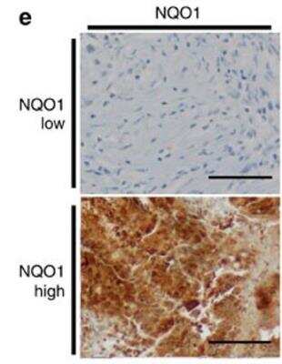 Immunohistochemistry: NQO-1 Antibody [NBP1-31355]