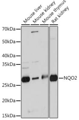 Western Blot: NQO-2 Antibody (5E0B2) [NBP3-16284]