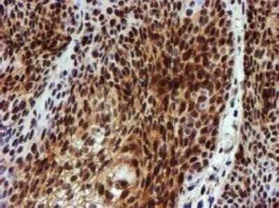 Immunohistochemistry: NQO-2 Antibody (OTI3G4) - Azide and BSA Free [NBP2-73049]