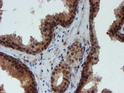 Immunohistochemistry: NQO-2 Antibody (OTI3G4) - Azide and BSA Free [NBP2-73049]