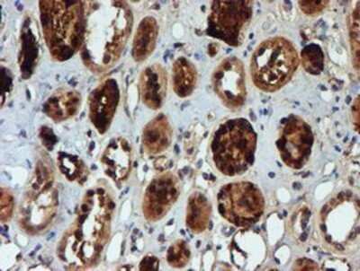 Immunohistochemistry: NQO-2 Antibody (OTI3G4) - Azide and BSA Free [NBP2-73049]