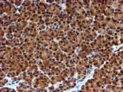 Immunohistochemistry: NQO-2 Antibody (OTI3G4) - Azide and BSA Free [NBP2-73049]