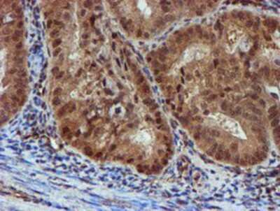 Immunohistochemistry-Paraffin: NQO-2 Antibody (OTI3G4) [NBP2-02062]