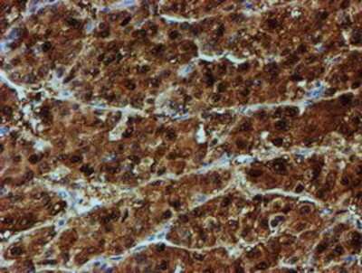 Immunohistochemistry-Paraffin: NQO-2 Antibody (OTI3G4) [NBP2-02062]