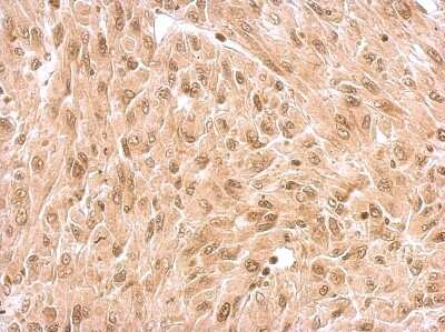 Immunohistochemistry-Paraffin: Rev-erb A alpha/NR1D1 Antibody [NBP2-19574]