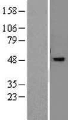 Western Blot: PNR/NR2E3 Overexpression Lysate [NBL1-13774]