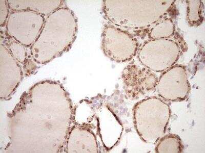 Immunohistochemistry-Paraffin: NR4A3/NOR1 Antibody (OTI5C2) [NBP2-46246]