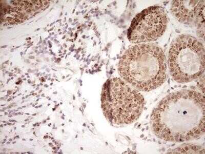 Immunohistochemistry: NR4A3/NOR1 Antibody (OTI5C2) - Azide and BSA Free [NBP2-73052]