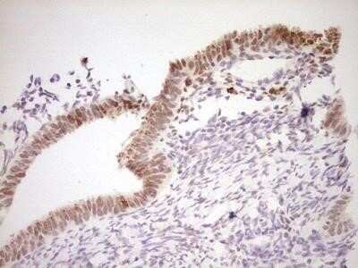Immunohistochemistry: NR4A3/NOR1 Antibody (OTI5C2) - Azide and BSA Free [NBP2-73052]