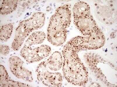 Immunohistochemistry: NR4A3/NOR1 Antibody (OTI5C2) - Azide and BSA Free [NBP2-73052]
