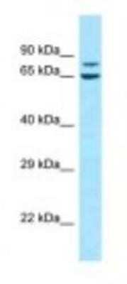 Western Blot: NRAGE/MAGED1 Antibody [NBP1-98411]
