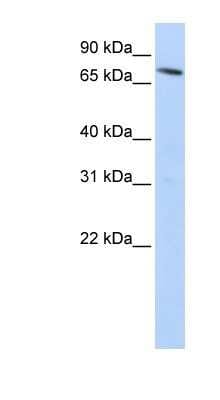 Western Blot: NRAMP2/SLC11A2/DMT1 Antibody [NBP1-59869]
