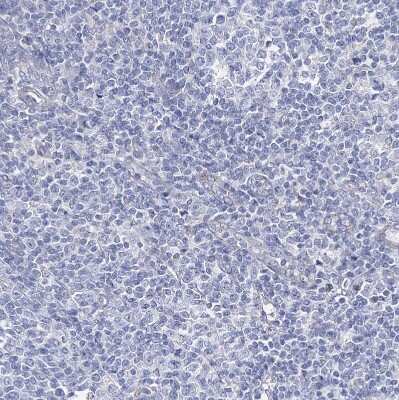 Immunohistochemistry-Paraffin: NRAP Antibody [NBP1-86267]