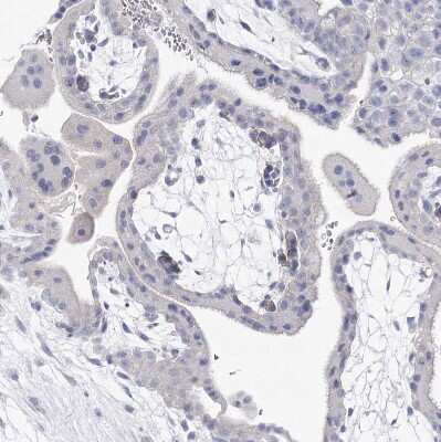 Immunohistochemistry-Paraffin: NRAP Antibody [NBP1-86267]