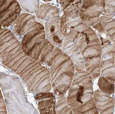Immunohistochemistry-Paraffin: NRAP Antibody [NBP2-32650]