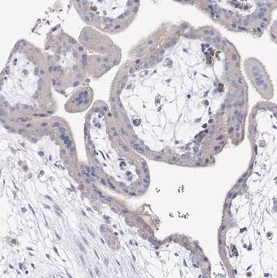 Immunohistochemistry-Paraffin: NRAP Antibody [NBP2-32650]