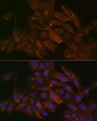 Immunocytochemistry/ Immunofluorescence: NRAS Antibody (6S6F3) [NBP3-16473]