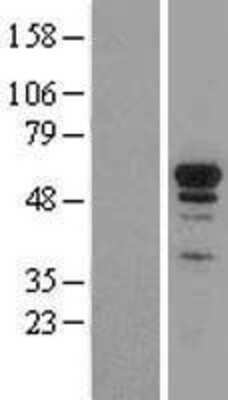 Western Blot: Nrf1 Overexpression Lysate [NBL1-13789]