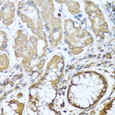 Immunohistochemistry-Paraffin: NRG4 Antibody - Azide and BSA Free [NBP2-93954]