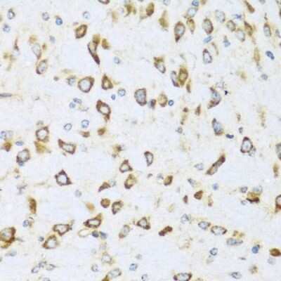 Immunohistochemistry-Paraffin: NRG4 Antibody - Azide and BSA Free [NBP2-93954]